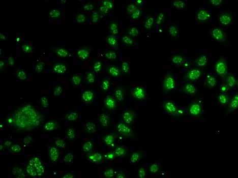 Immunocytochemistry/ Immunofluorescence: ARH Antibody [NBP3-38382] - Immunofluorescence analysis of A-549 cells using ARH Rabbit pAb.Secondary antibody: Cy3-conjugated Goat anti-Rabbit IgG (H+L) at 1:500 dilution.