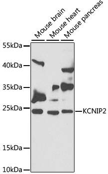 Western Blot: KChIP2 Antibody [NBP3-38383] - Western blot analysis of various lysates using KChIP2 Rabbit pAb at 1:1000 dilution.Secondary antibody: HRP-conjugated Goat anti-Rabbit IgG (H+L) at 1:10000 dilution.Lysates/proteins: 25ug per lane.Blocking buffer: 3% nonfat dry milk in TBST.Detection: ECL Basic Kit.Exposure time: 90s.