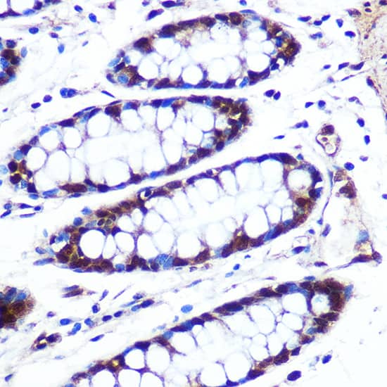 Immunohistochemistry: APIP Antibody [NBP3-38384] - Immunohistochemistry analysis of paraffin-embedded Human colon using APIP Rabbit pAb at dilution of 1:100 (40x lens). Microwave antigen retrieval performed with 0.01M PBS Buffer (pH 7.2) prior to IHC staining.