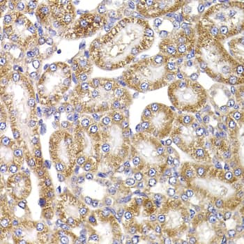 Immunohistochemistry: Apc5 Antibody [NBP3-38385] - Immunohistochemistry analysis of paraffin-embedded Rat kidney using [KO Validated] Apc5 Rabbit pAb at dilution of 1:100 (40x lens). Microwave antigen retrieval performed with 0.01M PBS Buffer (pH 7.2) prior to IHC staining.