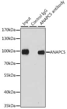 Immunoprecipitation: Apc5 Antibody [NBP3-38385] - Immunoprecipitation analysis of 200 ug extracts of MCF-7 cells, using 3 ug Apc5 antibody. Western blot was performed from the immunoprecipitate using Apc5 antibody at a dilution of 1:1000.