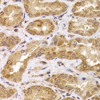 Immunohistochemistry Apc5 Antibody