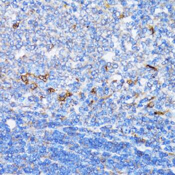 Immunohistochemistry: NDE1 Antibody [NBP3-38386] - Immunohistochemistry analysis of paraffin-embedded Rat spleen using NDE1 Rabbit pAb at dilution of 1:100 (40x lens). Microwave antigen retrieval performed with 0.01M PBS Buffer (pH 7.2) prior to IHC staining.