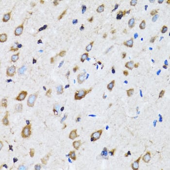 Immunohistochemistry NDE1 Antibody