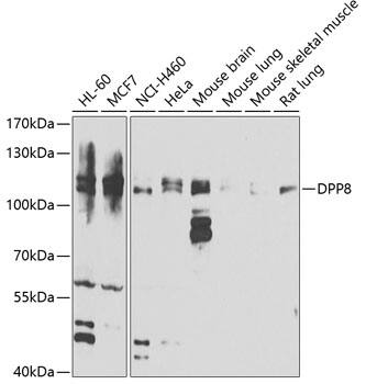 Western Blot: DPP8 Antibody [NBP3-38387] - Western blot analysis of various lysates using DPP8 Rabbit pAb at 1:1000 dilution.Secondary antibody: HRP-conjugated Goat anti-Rabbit IgG (H+L) at 1:10000 dilution.Lysates/proteins: 25ug per lane.Blocking buffer: 3% nonfat dry milk in TBST.Detection: ECL Basic Kit.Exposure time: 30s.