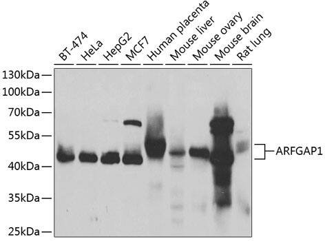 Western Blot: ARFGAP1 Antibody [NBP3-38388] - Western blot analysis of various lysates using ARFGAP1 Rabbit pAb at 1:1000 dilution.Secondary antibody: HRP-conjugated Goat anti-Rabbit IgG (H+L) at 1:10000 dilution.Lysates/proteins: 25ug per lane.Blocking buffer: 3% nonfat dry milk in TBST.Detection: ECL Basic Kit.Exposure time: 3s.