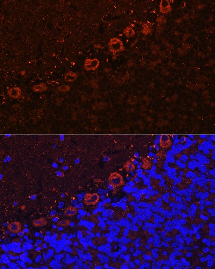 Immunocytochemistry/ Immunofluorescence: Als2 Antibody [NBP3-38389] - Immunofluorescence analysis of paraffin-embedded rat brain using Als2 Rabbit pAb at dilution of 1:100 (40x lens). Secondary antibody: Cy3-conjugated Goat anti-Rabbit IgG (H+L) at 1:500 dilution. Blue: DAPI for nuclear staining.