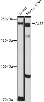 Western Blot: Als2 Antibody [NBP3-38389] - Western blot analysis of various lysates using Als2 Rabbit pAb at 1:1000 dilution.Secondary antibody: HRP-conjugated Goat anti-Rabbit IgG (H+L) at 1:10000 dilution.Lysates/proteins: 25ug per lane.Blocking buffer: 3% nonfat dry milk in TBST.Detection: ECL Basic Kit.Exposure time: 90s.