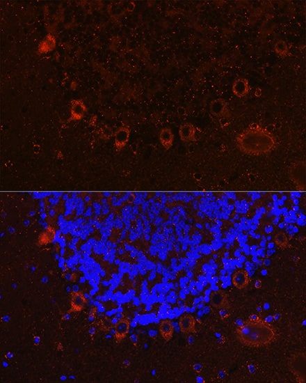 Immunocytochemistry/ Immunofluorescence: Als2 Antibody [NBP3-38389] - Immunofluorescence analysis of paraffin-embedded mouse brain using Als2 Rabbit pAb at dilution of 1:100 (40x lens). Secondary antibody: Cy3-conjugated Goat anti-Rabbit IgG (H+L) at 1:500 dilution. Blue: DAPI for nuclear staining.