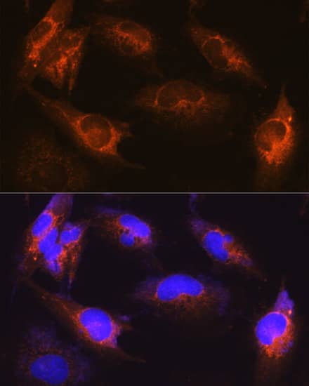 Immunocytochemistry/ Immunofluorescence: Als2 Antibody [NBP3-38389] - Immunofluorescence analysis of U-251MG cells using Als2 Rabbit pAb at dilution of 1:100 (40x lens). Secondary antibody: Cy3-conjugated Goat anti-Rabbit IgG (H+L) at 1:500 dilution. Blue: DAPI for nuclear staining.