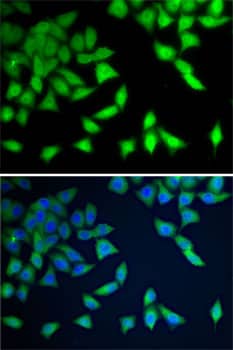 Immunocytochemistry/ Immunofluorescence: WDR77 Antibody [NBP3-38391] - Immunofluorescence analysis of A-549 cells using WDR77 Rabbit pAb. Secondary antibody: Cy3-conjugated Goat anti-Rabbit IgG (H+L) at 1:500 dilution. Blue: DAPI for nuclear staining.