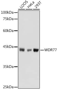 Western Blot: WDR77 Antibody [NBP3-38391] - Western blot analysis of various lysates using WDR77 Rabbit pAb at 1:1000 dilution.Secondary antibody: HRP-conjugated Goat anti-Rabbit IgG (H+L) at 1:10000 dilution.Lysates/proteins: 25ug per lane.Blocking buffer: 3% nonfat dry milk in TBST.Detection: ECL Basic Kit.Exposure time: 1s.