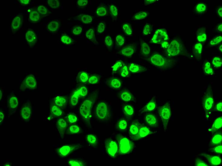 Immunocytochemistry/ Immunofluorescence: FIP1L1 Antibody [NBP3-38392] - Immunofluorescence analysis of A-549 cells using FIP1L1 Rabbit pAb.