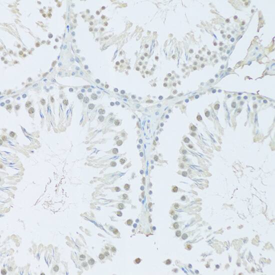 Immunohistochemistry: FIP1L1 Antibody [NBP3-38392] - Immunohistochemistry analysis of paraffin-embedded Rat testis using FIP1L1 Rabbit pAb at dilution of 1:100 (20x lens). Microwave antigen retrieval performed with 0.01M PBS Buffer (pH 7.2) prior to IHC staining.