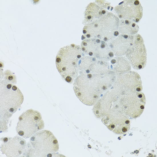 Immunohistochemistry: FIP1L1 Antibody [NBP3-38392] - Immunohistochemistry analysis of paraffin-embedded Mouse pancreas using FIP1L1 Rabbit pAb at dilution of 1:100 (40x lens). Microwave antigen retrieval performed with 0.01M PBS Buffer (pH 7.2) prior to IHC staining.