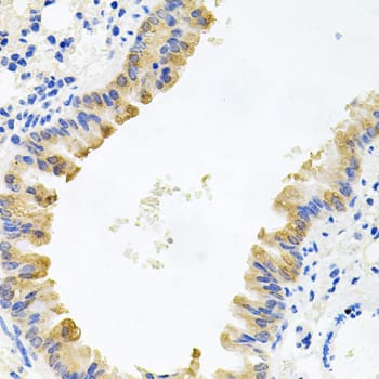 Immunohistochemistry ALKBH8 Antibody