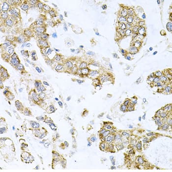 Immunohistochemistry ALKBH8 Antibody