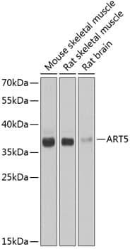 Western Blot: ART5 Antibody [NBP3-38394] - Western blot analysis of various lysates using ART5 Rabbit pAb at 1:1000 dilution.Secondary antibody: HRP-conjugated Goat anti-Rabbit IgG (H+L) at 1:10000 dilution.Lysates/proteins: 25ug per lane.Blocking buffer: 3% nonfat dry milk in TBST.Detection: ECL Basic Kit.Exposure time: 30s.