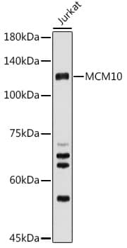 Western Blot: MCM10 Antibody [NBP3-38397] - Western blot analysis of lysates from Jurkat cells, using MCM10 Rabbit pAb at 1:500 dilution.Secondary antibody: HRP-conjugated Goat anti-Rabbit IgG (H+L) at 1:10000 dilution.Lysates/proteins: 25ug per lane.Blocking buffer: 3% nonfat dry milk in TBST.Detection: ECL Basic Kit.Exposure time: 180s.