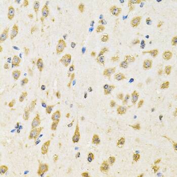 Immunohistochemistry: PTP epsilon Antibody [NBP3-38398] - Immunohistochemistry analysis of paraffin-embedded Mouse brain using PTP epsilon Rabbit pAb at dilution of 1:100 (40x lens). Microwave antigen retrieval performed with 0.01M PBS Buffer (pH 7.2) prior to IHC staining.