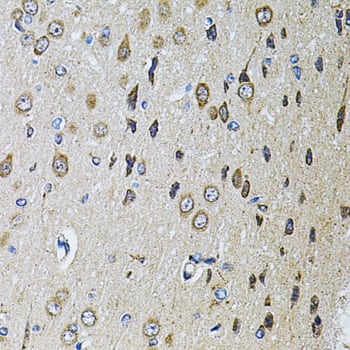 Immunohistochemistry PTP epsilon Antibody - BSA Free