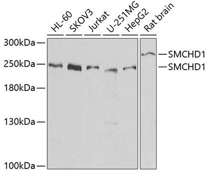 Western Blot: SMCHD1 Antibody [NBP3-38399] - Western blot analysis of various lysates using SMCHD1 Rabbit pAb at 1:1000 dilution.Secondary antibody: HRP-conjugated Goat anti-Rabbit IgG (H+L) at 1:10000 dilution.Lysates/proteins: 25ug per lane.Blocking buffer: 3% nonfat dry milk in TBST.Detection: ECL Basic Kit.Exposure time: 30s.
