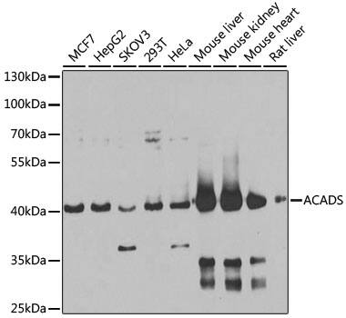 Western Blot: ACADS Antibody [NBP3-38401] - Western blot analysis of various lysates using ACADS Rabbit pAb at 1:1000 dilution.Secondary antibody: HRP-conjugated Goat anti-Rabbit IgG (H+L) at 1:10000 dilution.Lysates/proteins: 25ug per lane.Blocking buffer: 3% nonfat dry milk in TBST.Detection: ECL Basic Kit.Exposure time: 15s.