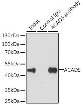 Immunoprecipitation: ACADS Antibody [NBP3-38401] - Immunoprecipitation analysis of 200 ug extracts of MCF-7 cells, using 3 ug ACADS antibody. Western blot was performed from the immunoprecipitate using ACADS antibody at a dilution of 1:1000.