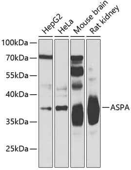 Western Blot: ASPA Antibody [NBP3-38405] - Western blot analysis of various lysates using ASPA Rabbit pAb at 1:500 dilution.Secondary antibody: HRP-conjugated Goat anti-Rabbit IgG (H+L) at 1:10000 dilution.Lysates/proteins: 25ug per lane.Blocking buffer: 3% nonfat dry milk in TBST.Detection: ECL Basic Kit.Exposure time: 10s.