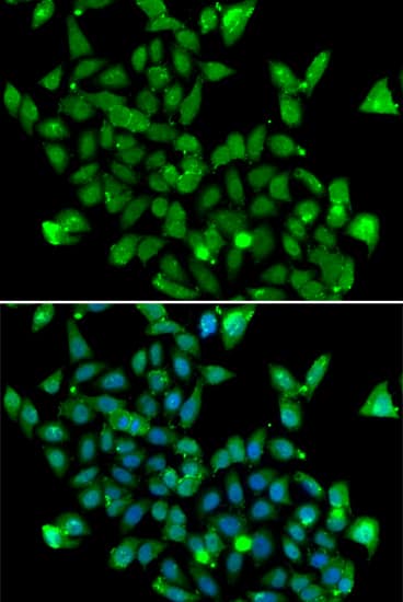 Immunocytochemistry/ Immunofluorescence: ASPA Antibody [NBP3-38405] - Immunofluorescence analysis of MCF-7 cells using ASPA Rabbit pAb. Secondary antibody: Cy3-conjugated Goat anti-Rabbit IgG (H+L) at 1:500 dilution. Blue: DAPI for nuclear staining.