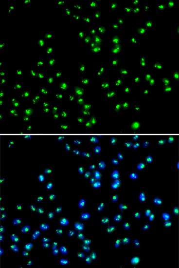 Immunocytochemistry/ Immunofluorescence: NAT10 Antibody [NBP3-38407] - Immunofluorescence analysis of MCF-7 cells using NAT10 Rabbit pAb. Secondary antibody: Cy3-conjugated Goat anti-Rabbit IgG (H+L) at 1:500 dilution. Blue: DAPI for nuclear staining.