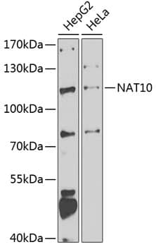 Western Blot: NAT10 Antibody [NBP3-38407] - Western blot analysis of various lysates using NAT10 Rabbit pAb at 1:1000 dilution.Secondary antibody: HRP-conjugated Goat anti-Rabbit IgG (H+L) at 1:10000 dilution.Lysates/proteins: 25ug per lane.Blocking buffer: 3% nonfat dry milk in TBST.Detection: ECL Enhanced Kit.Exposure time: 90s.