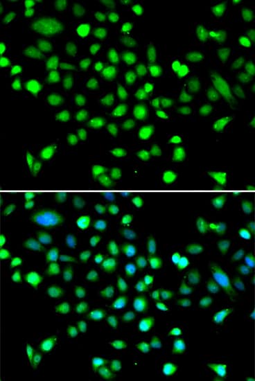Immunocytochemistry/ Immunofluorescence: AMPK gamma 1 Antibody [NBP3-38409] - Immunofluorescence analysis of MCF-7 cells using AMPK gamma 1 Rabbit pAb. Secondary antibody: Cy3-conjugated Goat anti-Rabbit IgG (H+L) at 1:500 dilution. Blue: DAPI for nuclear staining.