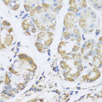 Immunohistochemistry: AMPK gamma 1 Antibody [NBP3-38409] - Immunohistochemistry analysis of paraffin-embedded Human stomach using AMPK gamma 1 Rabbit pAb at dilution of 1:100 (40x lens). Microwave antigen retrieval performed with 0.01M PBS Buffer (pH 7.2) prior to IHC staining.