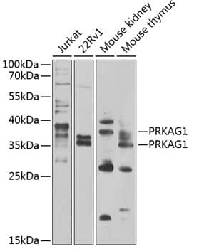 Western Blot: AMPK gamma 1 Antibody [NBP3-38409] - Western blot analysis of various lysates using AMPK gamma 1 Rabbit pAb at 1:1000 dilution.Secondary antibody: HRP-conjugated Goat anti-Rabbit IgG (H+L) at 1:10000 dilution.Lysates/proteins: 25ug per lane.Blocking buffer: 3% nonfat dry milk in TBST.Detection: ECL Enhanced Kit.Exposure time: 60s.
