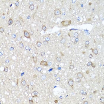 Immunohistochemistry: AMPK gamma 1 Antibody [NBP3-38409] - Immunohistochemistry analysis of paraffin-embedded Rat brain using AMPK gamma 1 Rabbit pAb at dilution of 1:100 (40x lens). Microwave antigen retrieval performed with 0.01M PBS Buffer (pH 7.2) prior to IHC staining.