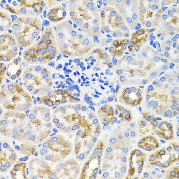 Immunohistochemistry: AMPK gamma 1 Antibody [NBP3-38409] - Immunohistochemistry analysis of paraffin-embedded Mouse kidney using AMPK gamma 1 Rabbit pAb at dilution of 1:100 (40x lens). Microwave antigen retrieval performed with 0.01M PBS Buffer (pH 7.2) prior to IHC staining.