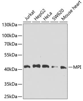 Western Blot: Mannose Phosphate Isomerase Antibody [NBP3-38410] - Western blot analysis of various lysates using Mannose Phosphate Isomerase Rabbit pAb at 1:1000 dilution.Secondary antibody: HRP-conjugated Goat anti-Rabbit IgG (H+L) at 1:10000 dilution.Lysates/proteins: 25ug per lane.Blocking buffer: 3% nonfat dry milk in TBST.Detection: ECL Basic Kit.Exposure time: 30s.