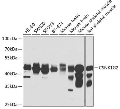 Western Blot: Casein Kinase 1 gamma 2 Antibody [NBP3-38411] - Western blot analysis of various lysates using Casein Kinase 1 gamma 2 Rabbit pAb at 1:1000 dilution.Secondary antibody: HRP-conjugated Goat anti-Rabbit IgG (H+L) at 1:10000 dilution.Lysates/proteins: 25ug per lane.Blocking buffer: 3% nonfat dry milk in TBST.Detection: ECL Basic Kit.Exposure time: 30s.