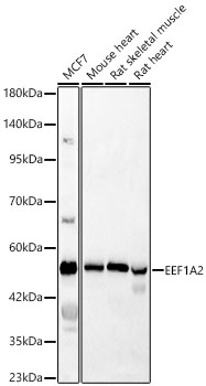 Western Blot: EEF1A2 Antibody [NBP3-38412] - Western Blot analysis of various lysates using EEF1A2 Rabbit pAb at 1:600 dilution. Secondary antibody: HRP Goat Anti-Rabbit IgG (H+L) at 1:10000 dilution. Lysates / proteins: 25 ug per lane. Blocking buffer: 3 % nonfat dry milk in TBST. Detection: ECL Basic Kit. Exposure time: 20s.