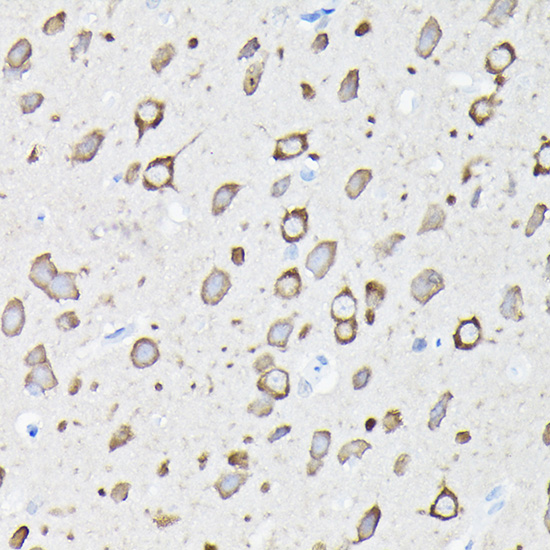 Immunohistochemistry: EEF1A2 Antibody [NBP3-38412] - Immunohistochemistry analysis of EEF1A2 in paraffin-embedded rat brain tissue using EEF1A2 Rabbit pAb at a dilution of 1:100 (40x lens). High pressure antigen retrieval was performed with 0.01 M citrate buffer (pH 6.0) prior to IHC staining.