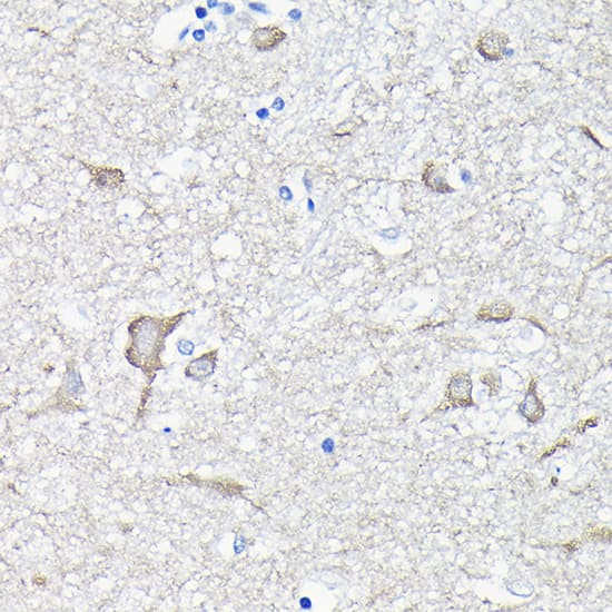 Immunohistochemistry: EEF1A2 Antibody [NBP3-38412] - Immunohistochemistry analysis of paraffin-embedded Mouse brain tissue using EEF1A2 Rabbit pAb  at a dilution of 1:100 (40x lens). High pressure antigen retrieval was performed with 0.01 M citrate buffer (pH 6.0) prior to IHC staining.