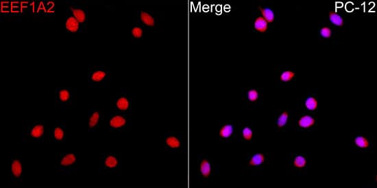 Immunohistochemistry: EEF1A2 Antibody [NBP3-38412] - Immunohistochemistry analysis of paraffin-embedded Rat brain tissue using EEF1A2 Rabbit pAb  at a dilution of 1:100 (40x lens). High pressure antigen retrieval was performed with 0.01 M citrate buffer (pH 6.0) prior to IHC staining.