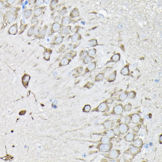 Immunohistochemistry: EEF1A2 Antibody [NBP3-38412] - Immunohistochemistry analysis of paraffin-embedded Human brain tissue using EEF1A2 Rabbit pAb  at a dilution of 1:100 (40x lens). High pressure antigen retrieval was performed with 0.01 M citrate buffer (pH 6.0) prior to IHC staining.