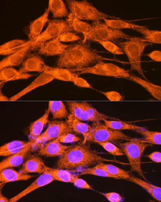 Immunocytochemistry/ Immunofluorescence: PHKG2 Antibody [NBP3-38415] - Immunofluorescence analysis of NIH-3T3 cells using PHKG2 Rabbit pAb at dilution of 1:100 (40x lens). Secondary antibody: Cy3-conjugated Goat anti-Rabbit IgG (H+L) at 1:500 dilution. Blue: DAPI for nuclear staining.