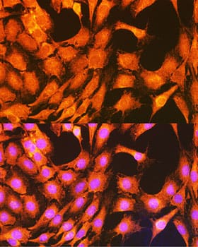 Immunocytochemistry/ Immunofluorescence: PHKG2 Antibody [NBP3-38415] - Immunofluorescence analysis of C6 cells using PHKG2 Rabbit pAb at dilution of 1:100 (40x lens). Secondary antibody: Cy3-conjugated Goat anti-Rabbit IgG (H+L) at 1:500 dilution. Blue: DAPI for nuclear staining.