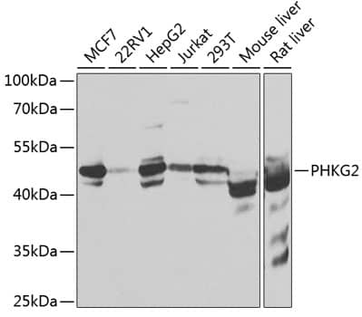 Western Blot: PHKG2 Antibody [NBP3-38415] - Western blot analysis of various lysates using PHKG2 Rabbit pAb at 1:1000 dilution.Secondary antibody: HRP-conjugated Goat anti-Rabbit IgG (H+L) at 1:10000 dilution.Lysates/proteins: 25ug per lane.Blocking buffer: 3% nonfat dry milk in TBST.Detection: ECL Basic Kit.Exposure time: 30s.