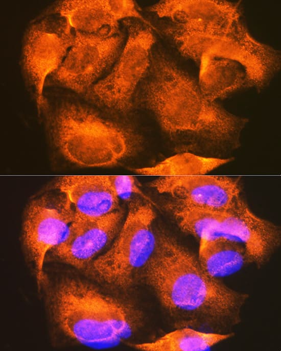 Immunocytochemistry/ Immunofluorescence: PHKG2 Antibody [NBP3-38415] - Immunofluorescence analysis of U-2 OS cells using PHKG2 Rabbit pAb at dilution of 1:100 (40x lens). Secondary antibody: Cy3-conjugated Goat anti-Rabbit IgG (H+L) at 1:500 dilution. Blue: DAPI for nuclear staining.