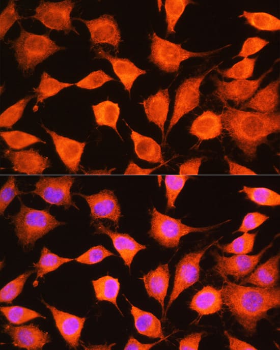 Immunocytochemistry/ Immunofluorescence: PHKG2 Antibody [NBP3-38415] - Immunofluorescence analysis of L929 cells using PHKG2 Rabbit pAb at dilution of 1:100 (40x lens). Secondary antibody: Cy3-conjugated Goat anti-Rabbit IgG (H+L) at 1:500 dilution. Blue: DAPI for nuclear staining.