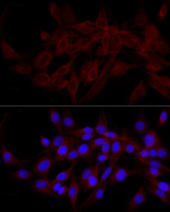 Immunocytochemistry/ Immunofluorescence: NDP52 Antibody [NBP3-38417] - Immunofluorescence analysis of PC-12 cells using NDP52 Rabbit pAb at dilution of 1:200 (40x lens). Secondary antibody: Cy3-conjugated Goat anti-Rabbit IgG (H+L) at 1:500 dilution. Blue: DAPI for nuclear staining.